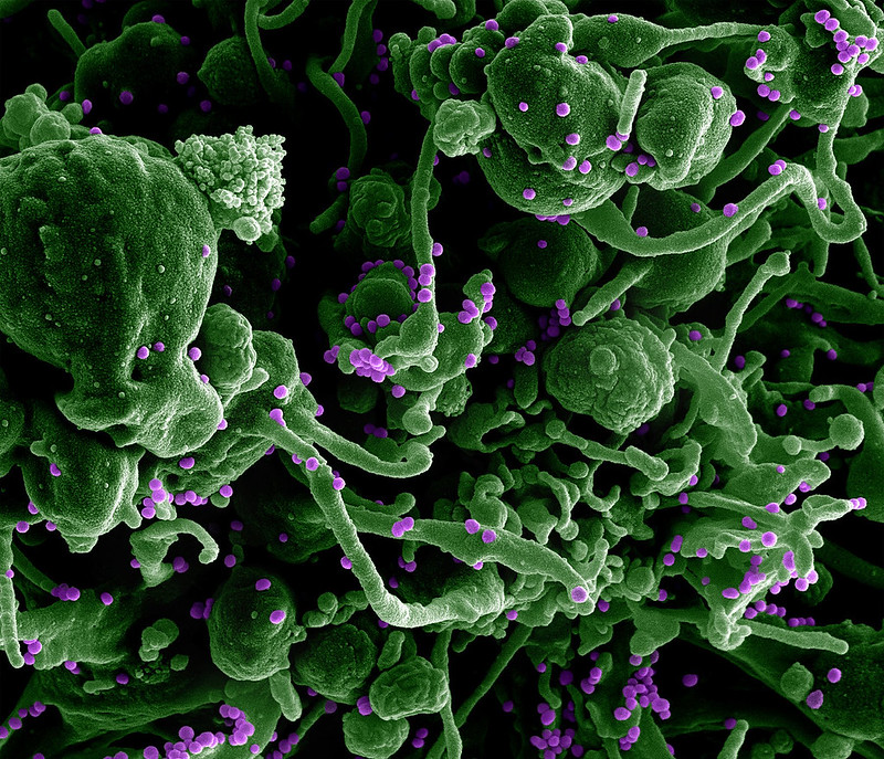 Scanning electron micrograph of Lassa virus budding off a cell. Lassa virus (LASV) is an arenavirus that causes Lassa hemorrhagic fever, a type of viral hemorrhagic fever (VHF) in humans and other primates. 